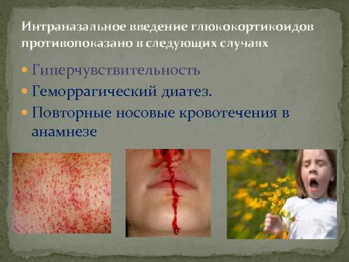 Интраназальное введение глюкокортикоидов противопоказано в следующих случаях Гиперчувствительность Геморрагический диатез. Повторные носовые кровотечения в