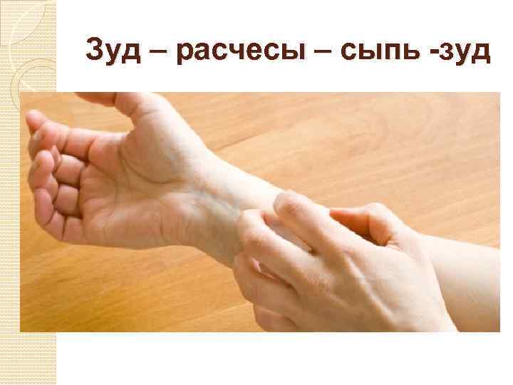 Зуд – расчесы – сыпь -зуд 