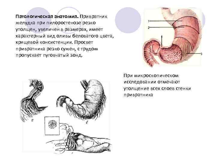 Где находится привратник