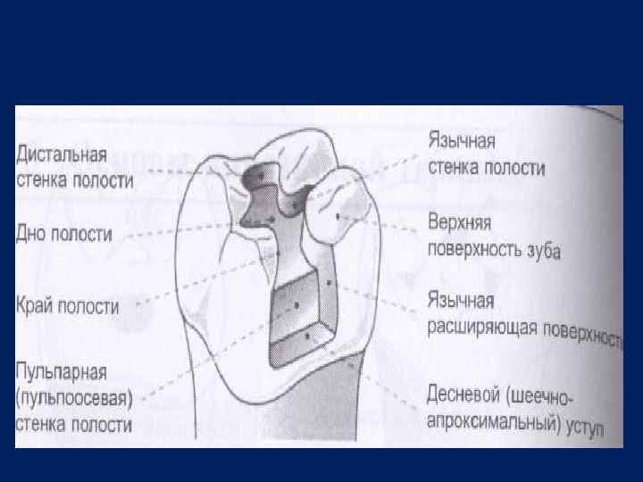 Придесневая стенка