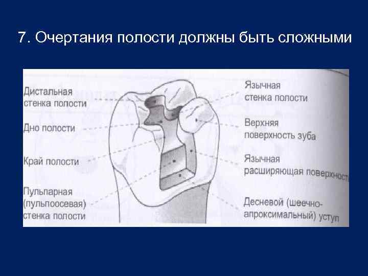 9 полостей. Стенки кариозной полости. Элементы кариозной полости. Строение кариозной полости. Элементы сформированной кариозной полости.