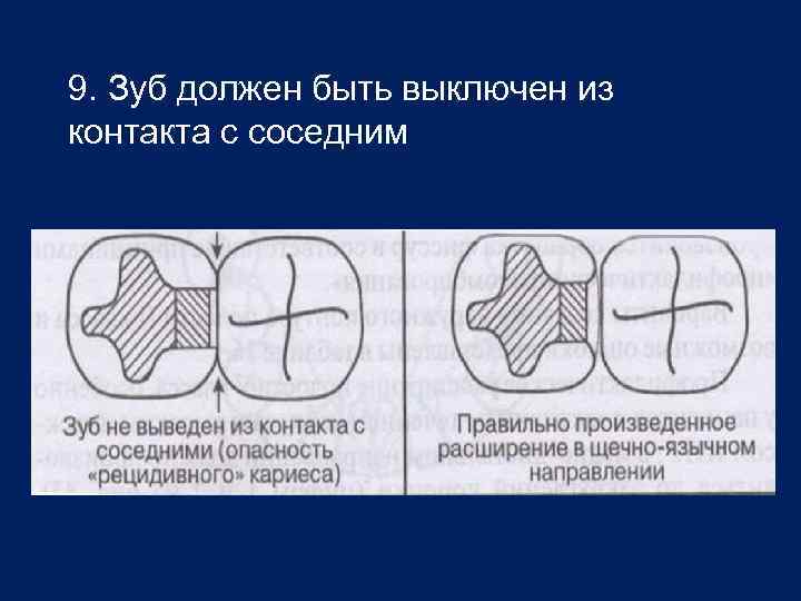 9. Зуб должен быть выключен из контакта с соседним 