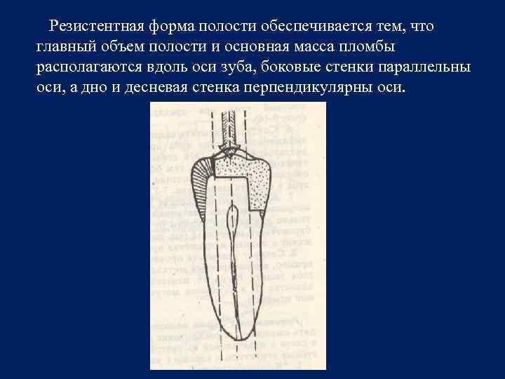 Объем полости. Резистентная форма полости. Боковые стенки полости зуба.