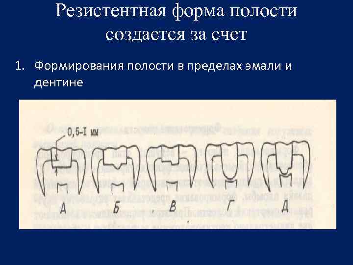 Полость формы. Резистентная форма полости. Полость формы это. Формирование резистентной формы кариозной полости.