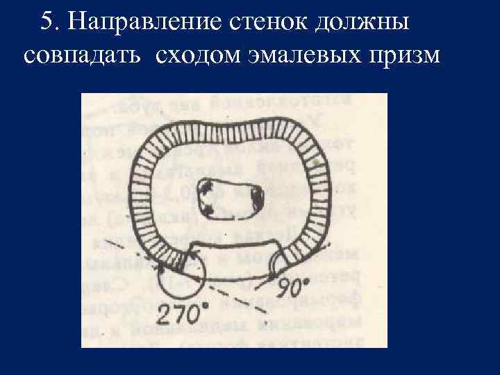 5. Направление стенок должны совпадать сходом эмалевых призм 