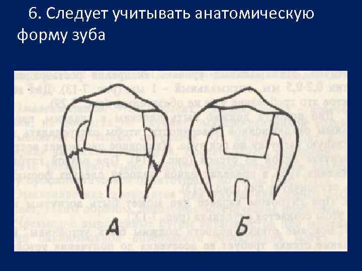 6. Следует учитывать анатомическую форму зуба 