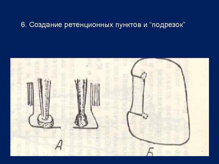 6. Создание ретенционных пунктов и “подрезок” 
