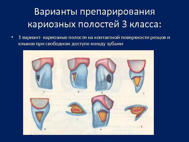 3 полости