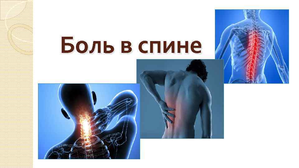 Болезненная тема. Актуальность проблемы боли в спине. Презентация на тему боль.