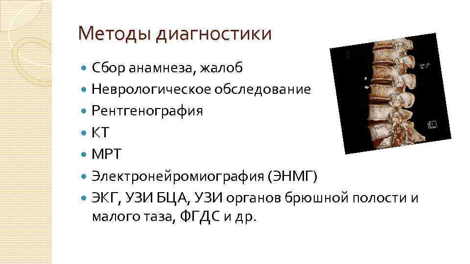Методы диагностики Сбор анамнеза, жалоб Неврологическое обследование Рентгенография КТ МРТ Электронейромиография (ЭНМГ) ЭКГ, УЗИ