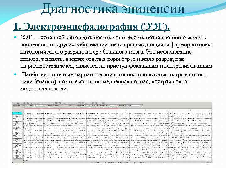 Диагностика эпилепсии 1. Электроэнцефалография (ЭЭГ). ЭЭГ — основной метод диагностики эпилепсии, позволяющий отличить эпилепсию