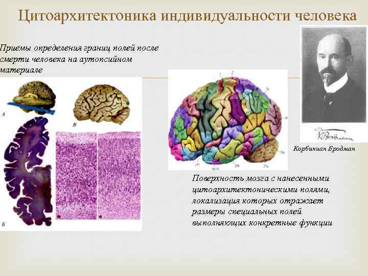 Цитоархитектоника индивидуальности человека Приемы определения границ полей после смерти человека на аутопсийном материале Корбиниан