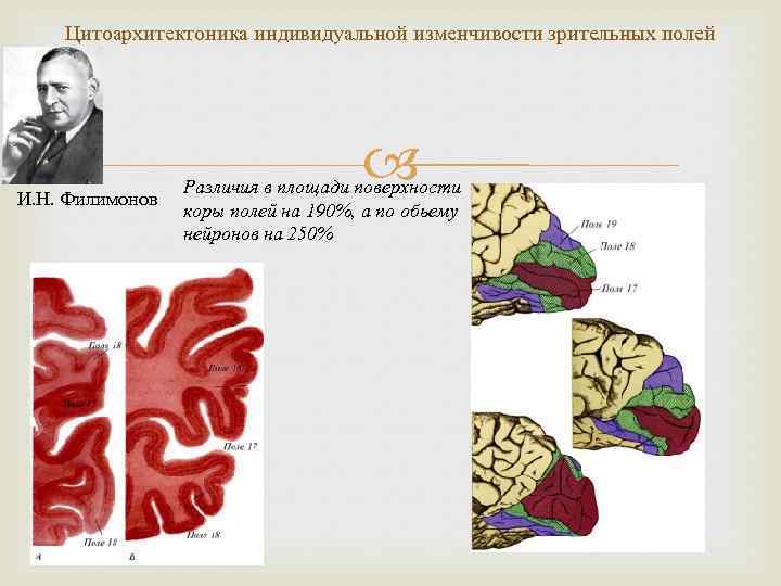 Цитоархитектоника индивидуальной изменчивости зрительных полей И. Н. Филимонов Различия в площади поверхности коры полей