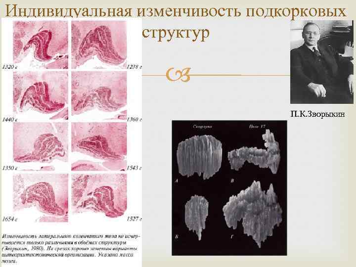 Индивидуальная изменчивость подкорковых структур П. К. Зворыкин 