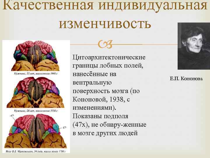 Качественная индивидуальная изменчивость Цитоархитектонические границы лобных полей, нанесённые на вентральную поверхность мозга (по Кононовой,