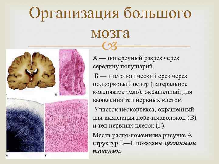 Организация большого мозга А — поперечный разрез через середину полушарий. Б — гистологический срез