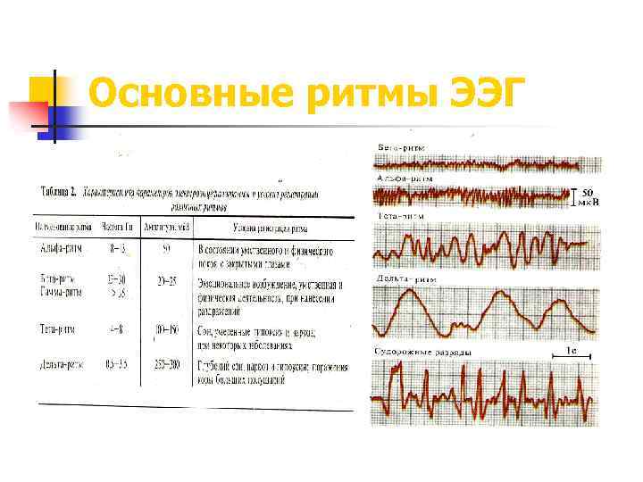 Основные ритмы ЭЭГ 