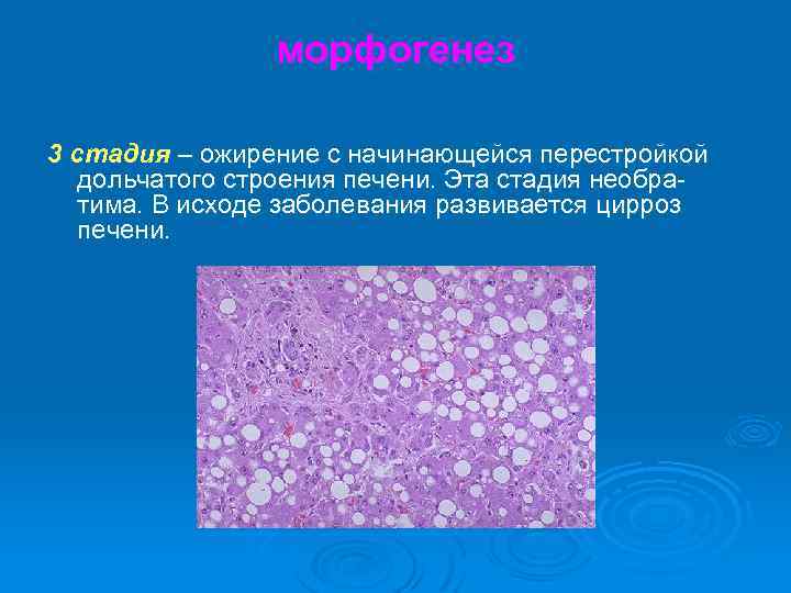 морфогенез 3 стадия – ожирение с начинающейся перестройкой дольчатого строения печени. Эта стадия необратима.