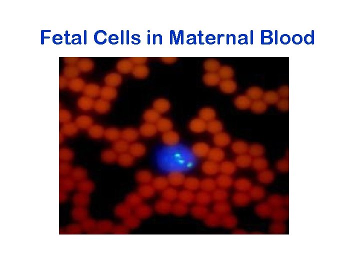 Fetal Cells in Maternal Blood 