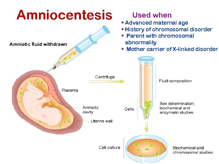 Amniocentesis Amniotic fluid withdrawn Used when § Advanced maternal age § History of chromosomal