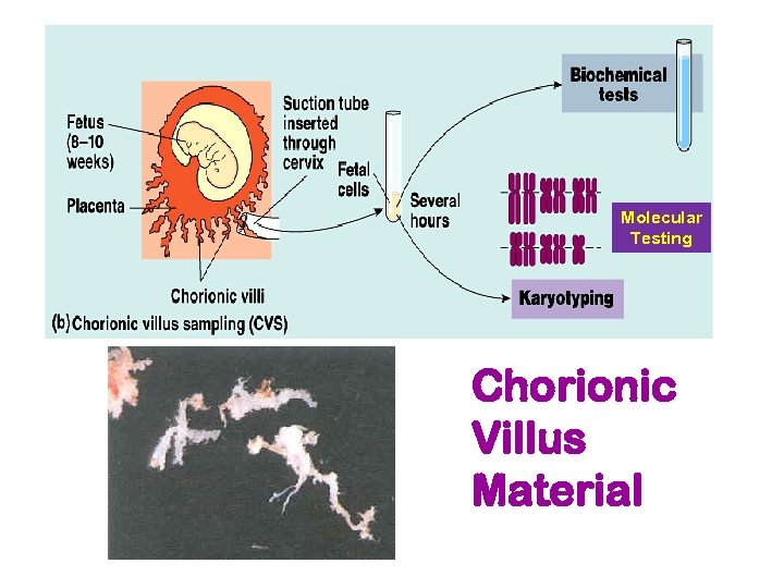 Molecular Testing Chorionic Villus Material 