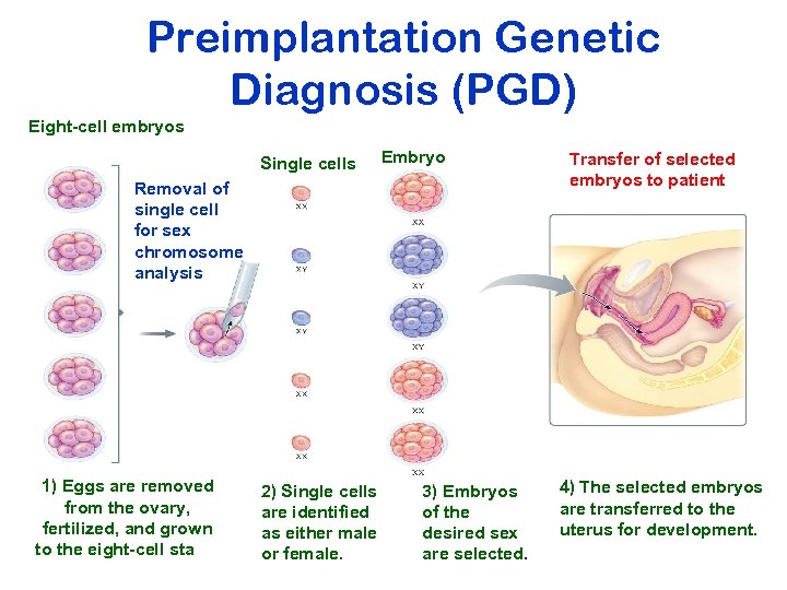 Preimplantation Genetic Diagnosis (PGD) Eight-cell embryos Single cells Embryos Removal of single cell for