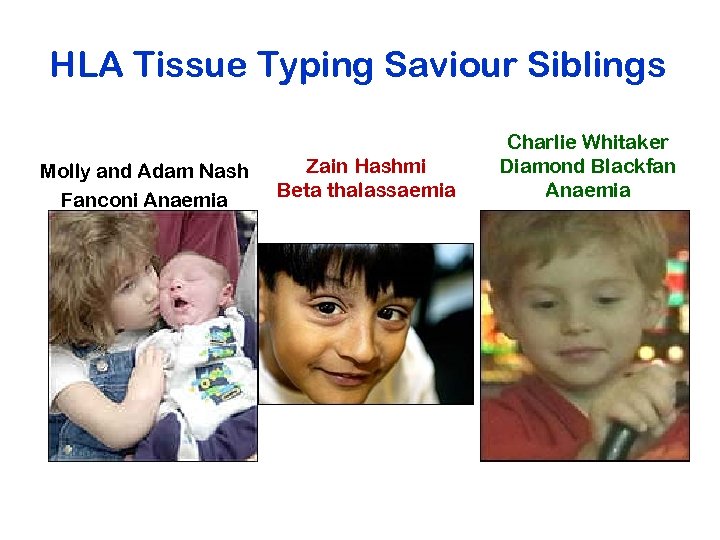 HLA Tissue Typing Saviour Siblings Molly and Adam Nash Fanconi Anaemia Zain Hashmi Beta