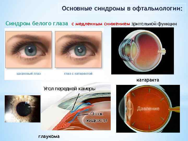 Od в офтальмологии