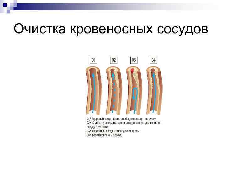 Очистка кровеносных сосудов 