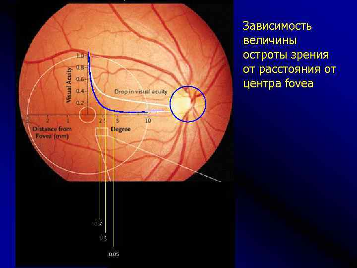 Заболевания сосудистой оболочки. Заболевания сосудистой оболочки глаза. Толщина сетчатки в фовеа. Патология сосудистой оболочки глаза презентация. Фовеа находится в сетчатке в середине.