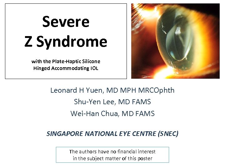 Severe Z Syndrome with the Plate-Haptic Silicone Hinged Accommodating IOL Leonard H Yuen, MD