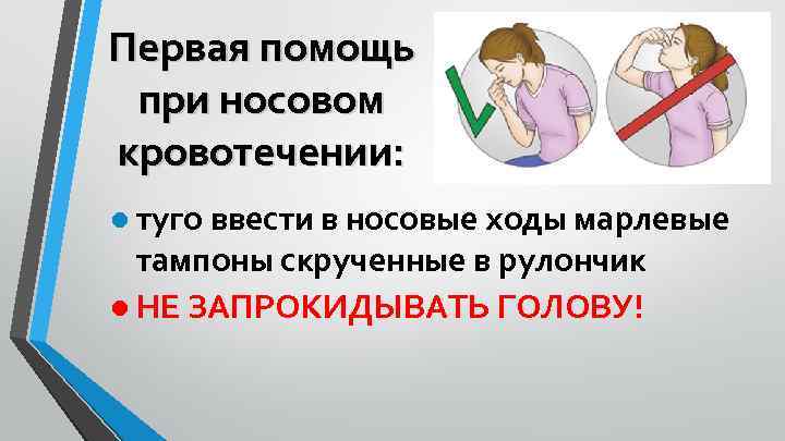 Первая помощь при носовом кровотечении: ● туго ввести в носовые ходы марлевые тампоны скрученные