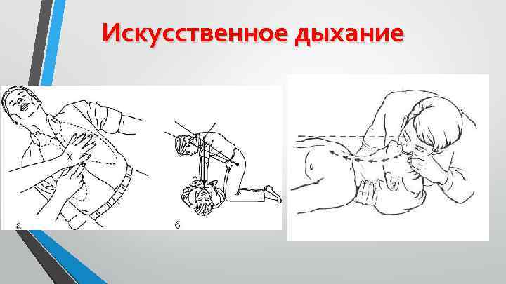 Искусственное дыхание 