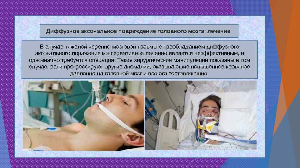 Диффузное аксональное повреждение головного мозга: лечение В случае тяжелой черепно-мозговой травмы с преобладанием диффузного