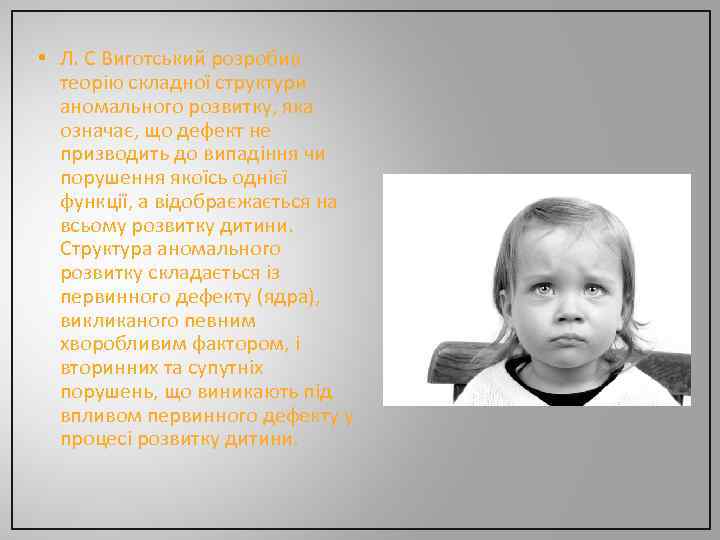  • Л. С Виготський розробив теорію складної структури аномального розвитку, яка означає, що