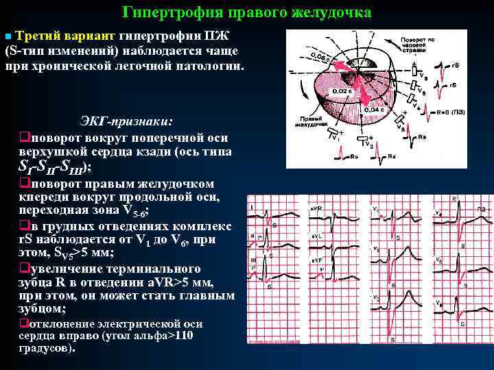 Патологии экг презентация