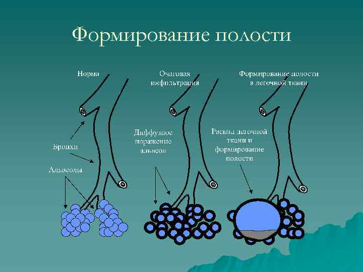 Формирование полости 