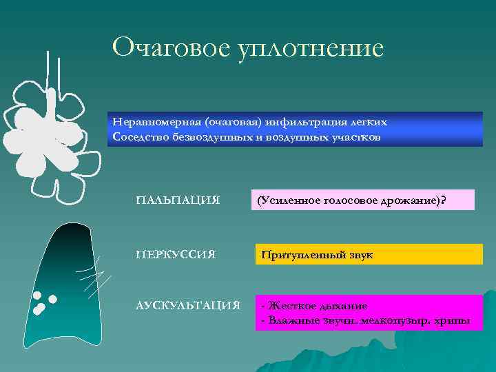 Очаговое уплотнение Неравномерная (очаговая) инфильтрация легких Соседство безвоздушных и воздушных участков ПАЛЬПАЦИЯ (Усиленное голосовое