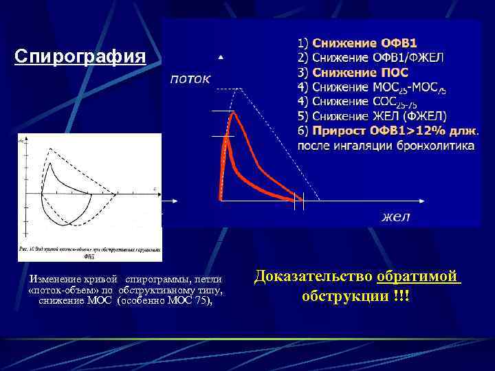 Спирография Изменение кривой спирограммы, петли «поток-объем» по обструктивному типу, снижение МОС (особенно МОС 75),