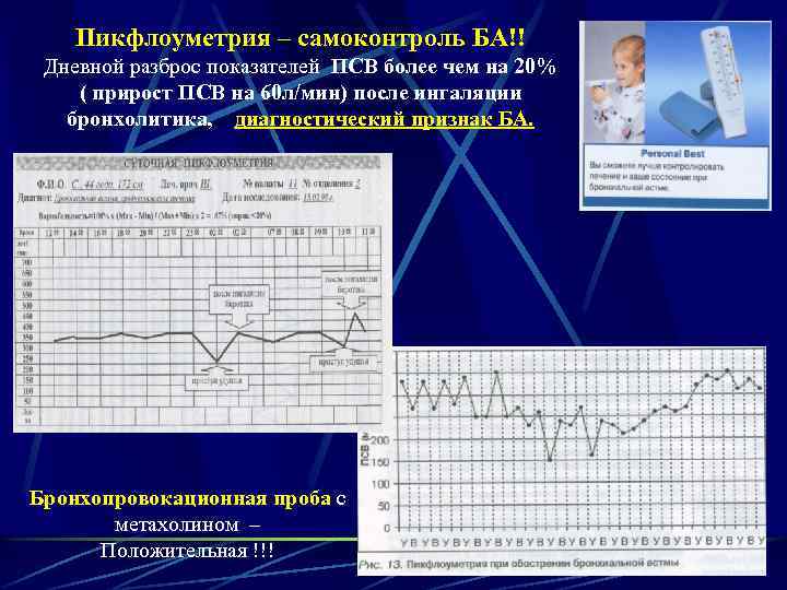 Пикфлоуметрия – самоконтроль БА!! Дневной разброс показателей ПСВ более чем на 20% ( прирост