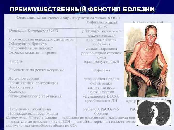 ПРЕИМУЩЕСТВЕННЫЙ ФЕНОТИП БОЛЕЗНИ 