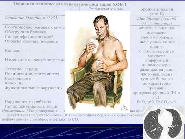 ПРЕИМУЩЕСТВЕННЫЙ ФЕНОТИП БОЛЕЗНИ 