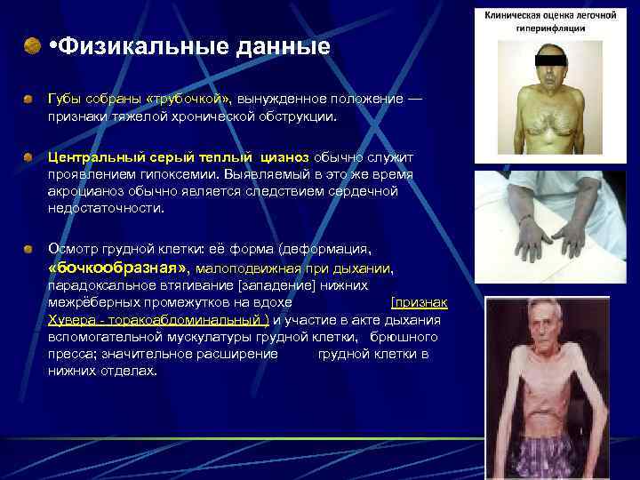  • Физикальные данные Губы собраны «трубочкой» , вынужденное положение — признаки тяжелой хронической