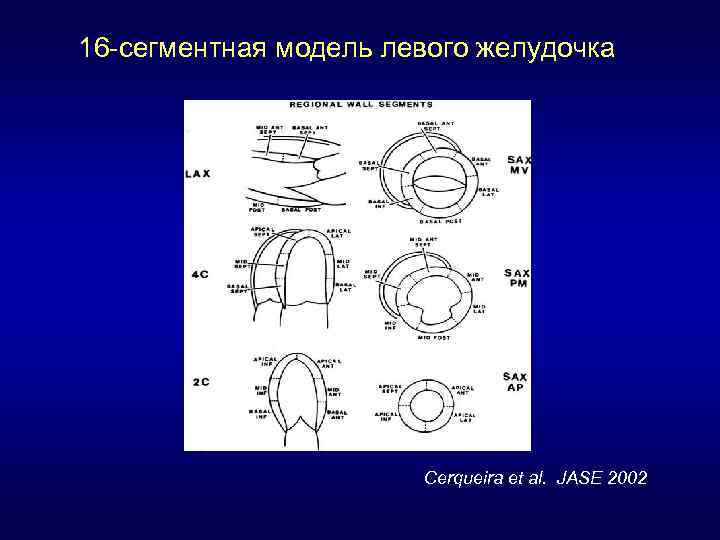 Проводимость левого желудочка