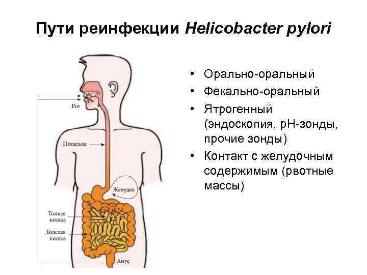 Пути реинфекции Helicobacter pylori • Орально-оральный • Фекально-оральный • Ятрогенный (эндоскопия, p. H-зонды, прочие