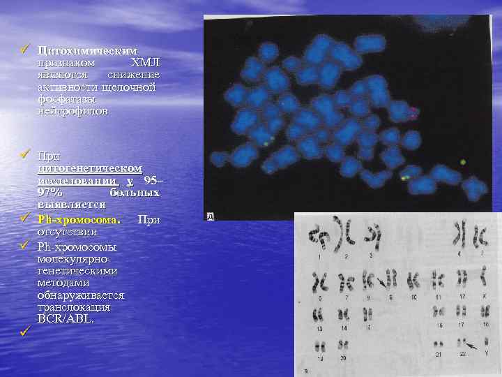 ü Цитохимическим признаком ХМЛ являются снижение активности щелочной фосфатазы нейтрофилов ü При ü ü