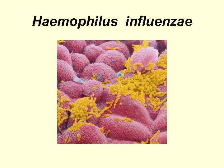 Haemophilus influenzae 