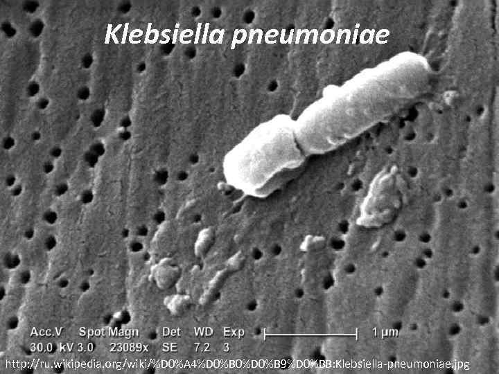 Klebsiella pneumoniae http: //ru. wikipedia. org/wiki/%D 0%A 4%D 0%B 0%D 0%B 9%D 0%BB: Klebsiella-pneumoniae.
