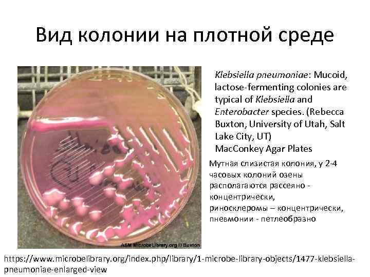 Вид колонии на плотной среде Klebsiella pneumoniae: Mucoid, lactose-fermenting colonies are typical of Klebsiella