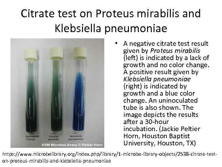 Citrate test on Proteus mirabilis and Klebsiella pneumoniae • A negative citrate test result